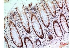 Immunohistochemistry (IHC) image for anti-Endothelial PAS Domain Protein 1 (EPAS1) (Ser343) antibody (ABIN3187839)