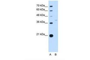 Image no. 1 for anti-Replication Factor C (Activator 1) 3, 38kDa (RFC3) (AA 91-140) antibody (ABIN6738211) (RFC3 Antikörper  (AA 91-140))
