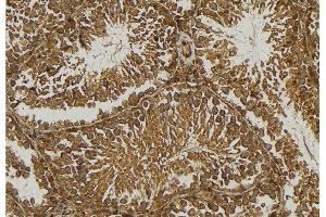 ABIN6276748 at 1/100 staining Mouse testis tissue by IHC-P. (BAD Antikörper  (Internal Region))