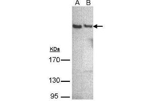 WB Image Sample (30 ug of whole cell lysate) A: A431 , B: Hep G2 , 5% SDS PAGE antibody diluted at 1:500 (PLCH1 Antikörper)