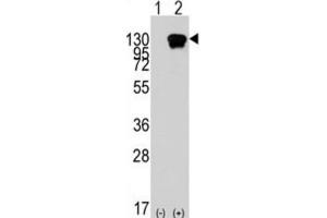Western Blotting (WB) image for anti-Receptor Tyrosine Kinase-Like Orphan Receptor 1 (ROR1) antibody (ABIN2924492) (ROR1 Antikörper)