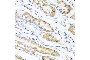 Immunohistochemistry of paraffin-embedded human stomach using LYZ antibody (ABIN5975352) at dilution of 1/100 (40x lens). (LYZ Antikörper)