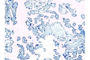 Immunohistochemistry (IHC) image for anti-Ionized Calcium-binding Adapter Molecule 1 (IBA1) (C-Term) antibody (ABIN184738)