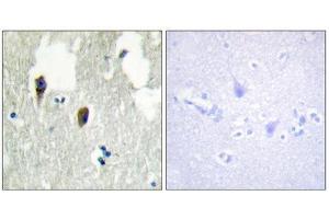 Immunohistochemistry (IHC) image for anti-Kelch-Like 3 (KLHL3) (N-Term) antibody (ABIN1850052) (KLHL3 Antikörper  (N-Term))