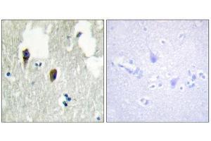 Immunohistochemistry (IHC) image for anti-Kelch-Like 3 (KLHL3) (N-Term) antibody (ABIN1850052) (KLHL3 Antikörper  (N-Term))