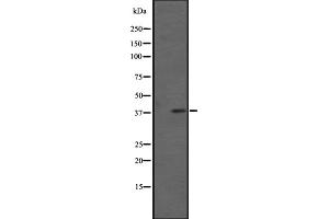 Western blot analysis of FPRL1 expression in Extracts from HL60 cells. (FPR2 Antikörper  (C-Term))