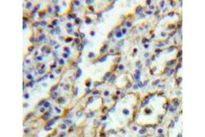 Used in DAB staining on fromalin fixed paraffin-embedded spleen tissue (IL5RA Antikörper  (AA 41-203))