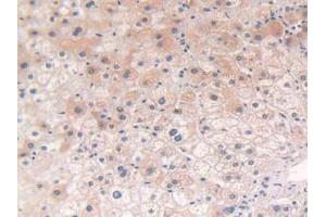 IHC-P analysis of Human Liver Tissue, with DAB staining. (POR Antikörper  (AA 77-518))