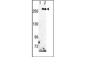 Western blot analysis of FASN (arrow) using rabbit polyclonal FASN Antibody (Fatty Acid Synthase Antikörper  (Middle Region))