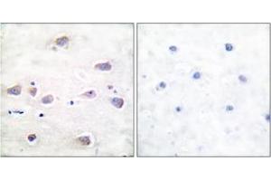 Immunohistochemistry analysis of paraffin-embedded human brain, using NMDAR1 (Phospho-Ser897) Antibody. (GRIN1/NMDAR1 Antikörper  (pSer897))