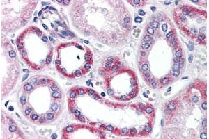 anti-PTK7 Protein tyrosine Kinase 7 (PTK7) (C-Term) antibody