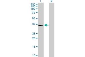 Western Blot analysis of AGPAT4 expression in transfected 293T cell line by AGPAT4 MaxPab polyclonal antibody. (AGPAT4 Antikörper  (AA 1-378))