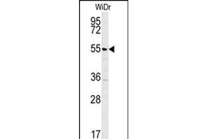 TSPYL4 Antibody (N-term) (ABIN652012 and ABIN2840495) western blot analysis in WiDr cell line lysates (35 μg/lane). (TSPY-Like 4 Antikörper  (N-Term))