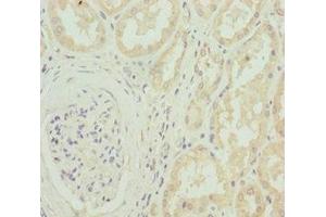 Immunohistochemistry of paraffin-embedded human kidney tissue using ABIN7175594 at dilution of 1:100 (CACNB1 Antikörper  (AA 429-598))