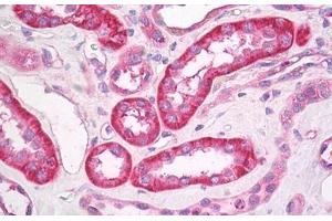 Human Kidney: Formalin-Fixed, Paraffin-Embedded (FFPE) (GABRB3 Antikörper  (AA 370-433))