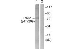 Western blot analysis of extracts from HeLa cells, using IRAK1 (Phospho-Thr209) Antibody. (IRAK1 Antikörper  (pThr209))