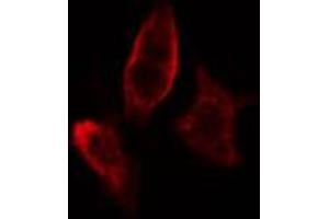 ABIN6267611 staining HeLa cells by IF/ICC. (LIPE Antikörper  (pSer554, pSer855))