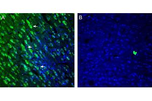 Expression of 5HT2A Receptor in rat cingulate cortex. (HTR2A Antikörper  (Extracellular, N-Term))