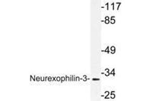 Western blot (WB) analysis of Neurexophilin-3 antibody in extracts from HT-29 cells. (NXPH3 Antikörper)