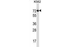 Western Blotting (WB) image for anti-Interleukin 1 Receptor-Like 2 (IL1RL2) antibody (ABIN2997308) (IL1RL2 Antikörper)