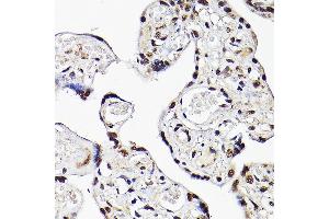 Immunohistochemistry of paraffin-embedded human placenta using TBX20 Rabbit pAb (ABIN7270698) at dilution of 1:100 (40x lens).