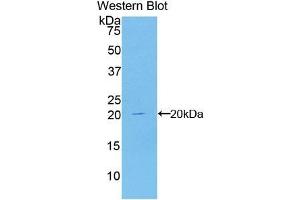 Detection of Recombinant CDKN2A, Human using Polyclonal Antibody to Cyclin Dependent Kinase Inhibitor 2A (CDKN2A) (CDKN2A Antikörper  (AA 8-156))