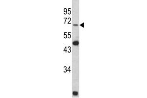 Western blot analysis of Lamin B2 antibody and Y79 lysate (Lamin B2 Antikörper  (AA 476-504))