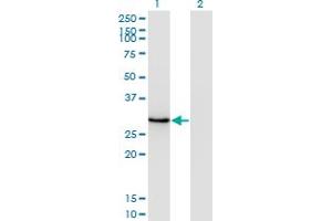 Western Blot analysis of DLX1 expression in transfected 293T cell line by DLX1 monoclonal antibody (M14), clone 4H7.