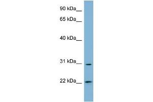 WB Suggested Anti-HSD17B14 Antibody Titration: 0. (HSD17B14 Antikörper  (N-Term))