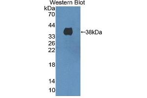 Figure. (HMGCL Antikörper  (AA 1-325))