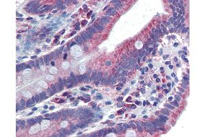 Immunohistochemistry (IHC) image for anti-Nuclear Receptor Subfamily 1, Group I, Member 2 (NR1I2) (AA 108-157) antibody (ABIN6741564)