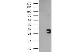 Image no. 1 for anti-Glioblastoma Amplified Sequence (GBAS) antibody (ABIN1498394) (GBAS Antikörper)
