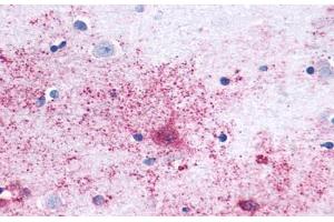 Anti-MAS1 antibody  ABIN1049039 IHC staining of human brain, neurons and glia. (MAS1 Antikörper  (Cytoplasmic Domain))