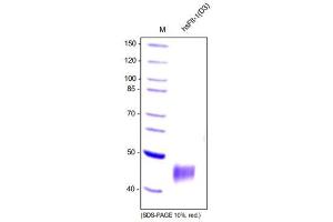 SDS-PAGE analysis of recombinant human soluble VEGFR-1D1-3 produced in insect cells.