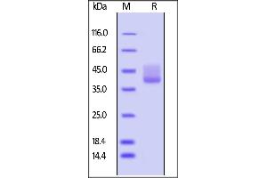 SDS-PAGE (SDS) image for Tumor Necrosis Factor Receptor Superfamily, Member 13C (TNFRSF13C) (AA 7-71) (Active) protein (Fc Tag) (ABIN5526588)