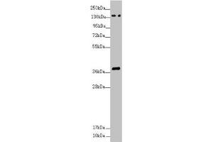 Western blot All lanes: SFI1 antibody at 4. (SFI1 Antikörper  (AA 1003-1242))
