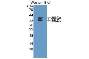 Western Blotting (WB) image for anti-Complement Fragment 3a (C3a) (AA 671-748) antibody (ABIN1858189) (C3a Antikörper  (AA 671-748))