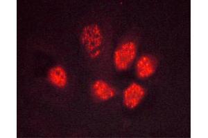 ABIN6267495 staining Hela cells by ICC/IF.