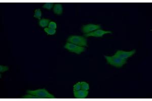 Detection of Trx in Human MCF7 cell using Polyclonal Antibody to Thioredoxin (Trx) (TXN Antikörper  (AA 1-105))