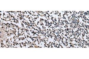 Immunohistochemistry of paraffin-embedded Human tonsil tissue using ZFP36 Polyclonal Antibody at dilution of 1:40(x200) (ZFP36 Antikörper)