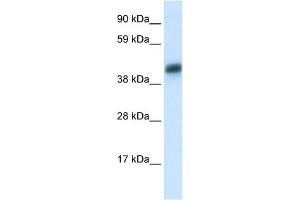 WB Suggested Antibody Titration:  0. (Asialoglycoprotein Receptor 1 Antikörper  (N-Term))