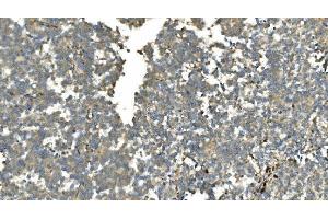 IHC analysis of Carbonic Anhydrase 13/CA13 using anti-Carbonic Anhydrase 13/CA13 antibody (ABIN7603164). (CA13 Antikörper  (N-Term))