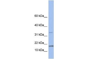 WB Suggested Anti-TCL1A Antibody Titration: 0. (TCL1A Antikörper  (N-Term))