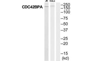 Western Blotting (WB) image for anti-CDC42 Binding Protein Kinase alpha (DMPK-Like) (CDC42BPA) (Internal Region) antibody (ABIN1852716) (CDC42BPA Antikörper  (Internal Region))
