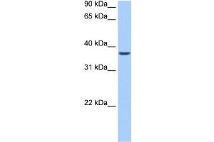 WB Suggested Anti-ALKBH8 Antibody Titration:  0. (ALKBH8 Antikörper  (N-Term))