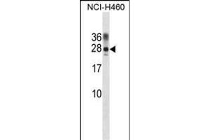 RAT Ppp1r2 Antibody (Center) (ABIN1881680 and ABIN2839055) western blot analysis in NCI- cell line lysates (35 μg/lane). (PPP1R2 Antikörper  (AA 49-77))
