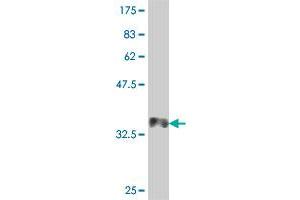 Western Blot detection against Immunogen (35. (PCGF1 Antikörper  (AA 105-187))