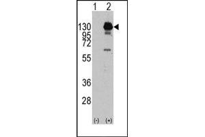 Image no. 1 for anti-Platelet Derived Growth Factor Receptor alpha (PDGFRA) (Tyr762) antibody (ABIN359910)