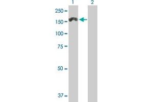 Western Blot analysis of MTMR3 expression in transfected 293T cell line by MTMR3 MaxPab polyclonal antibody. (MTMR3 Antikörper  (AA 1-1198))