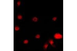 Immunofluorescent analysis of STK19 staining in A549 cells. (STK19 Antikörper)